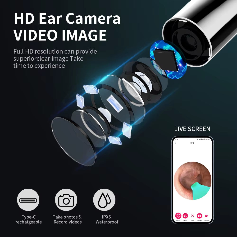 Otoscope Caméra Nettoyeur D'Oreille HD — Sans Fil