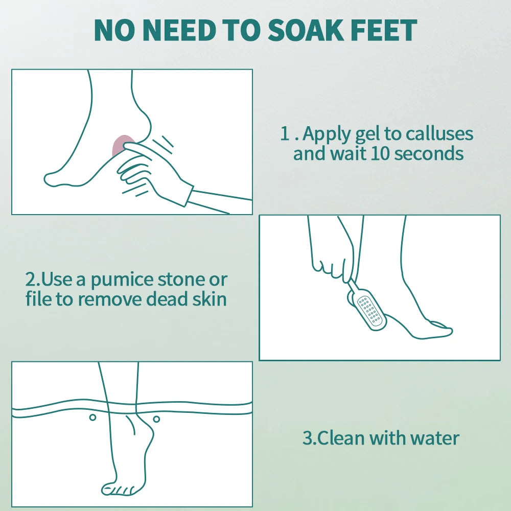 Kit Anti-Callosités Pieds — Râpe & Soin Talons